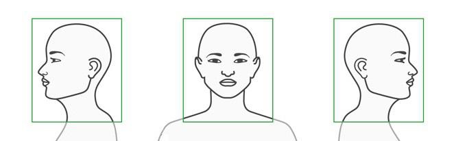 В каких раскурсах нужно фотографироваться для 3д моделирование перед операцией по пластике лица - 2 фото профиля и 1 анфас