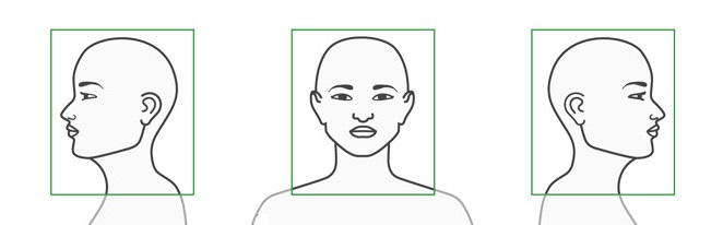 В каких раскурсах нужно фотографироваться для компьютерного моделирования перед операцией по пластике лица - 2 фото профиля и 1 анфас